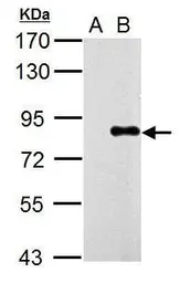 Anti-Influenza A virus PA protein antibody used in Western Blot (WB). GTX125932